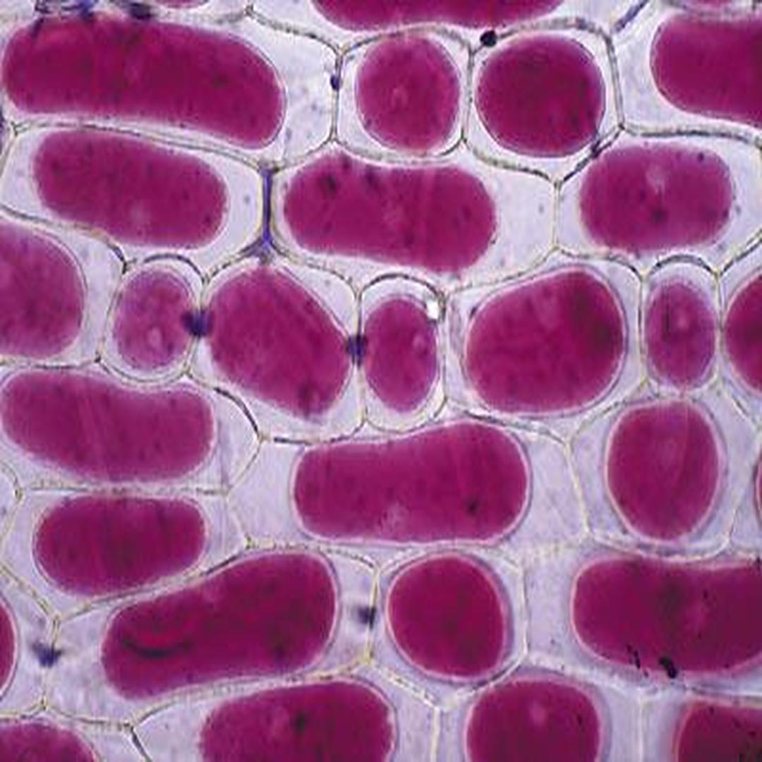 植物细胞质壁分离图片