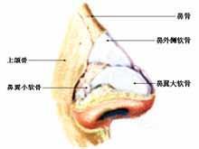 鼻骨骨折 快懂百科