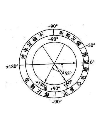 心电轴偏移 快懂百科