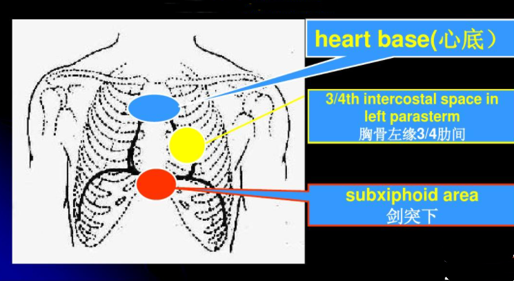 剑突下疼痛 快懂百科