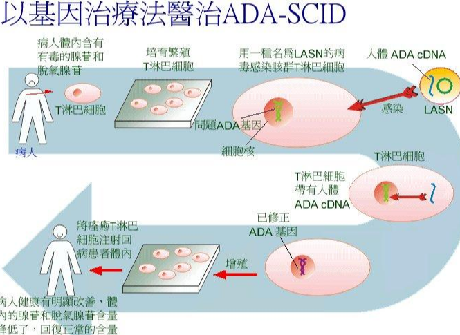 遗传性疾病基因治疗