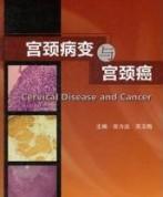 宫颈上皮内瘤变 快懂百科
