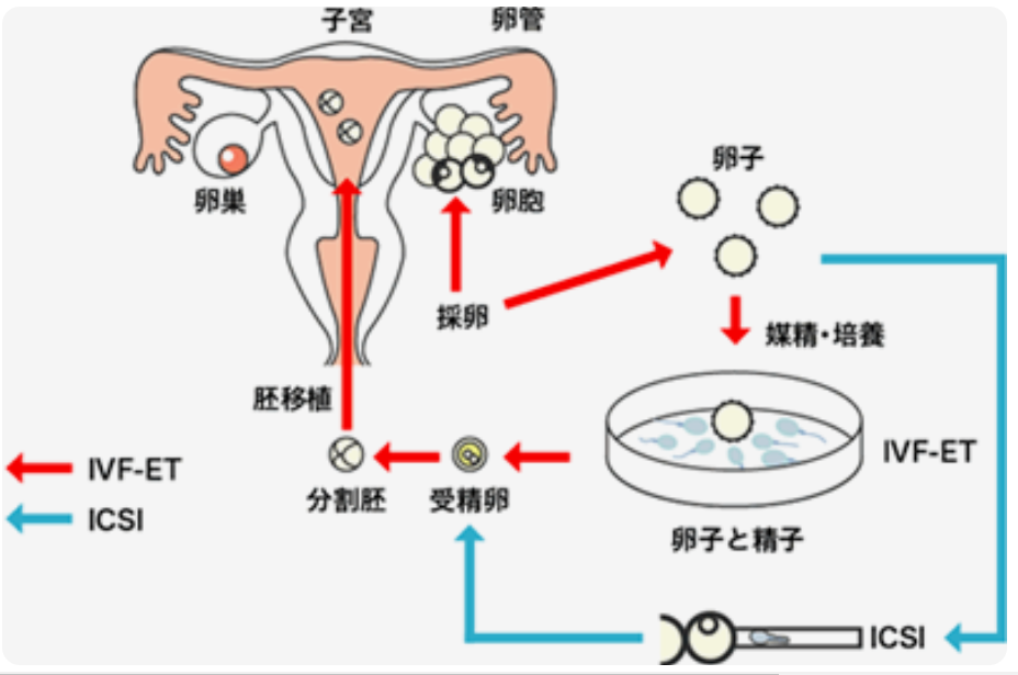 受精 体外 スケジュール｜体外受精（IVF）の基本知識