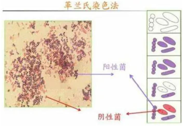 革兰氏染色 快懂百科