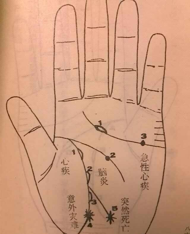 生命线 头条百科